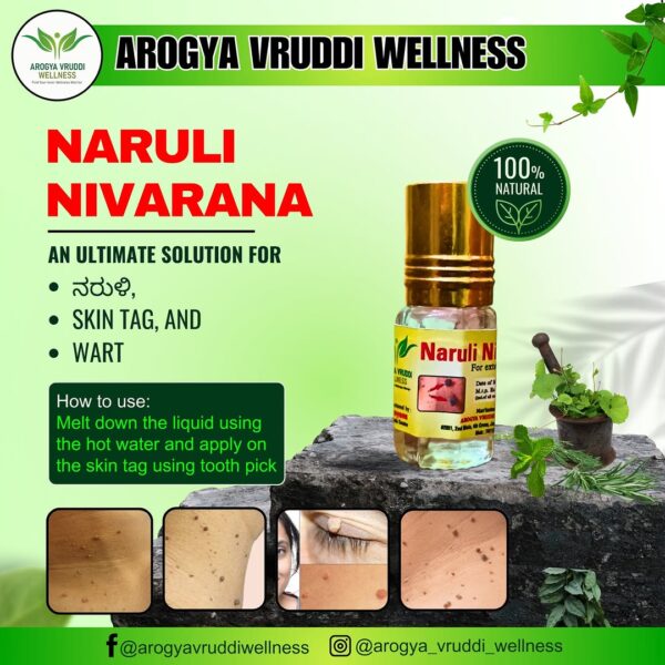 Naruli Nivarana - Image 3